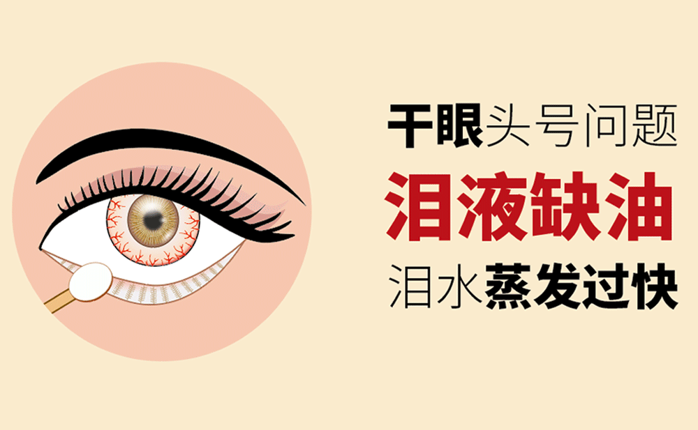 2023110317222383800663664.gif 眼部状态GIF.gif