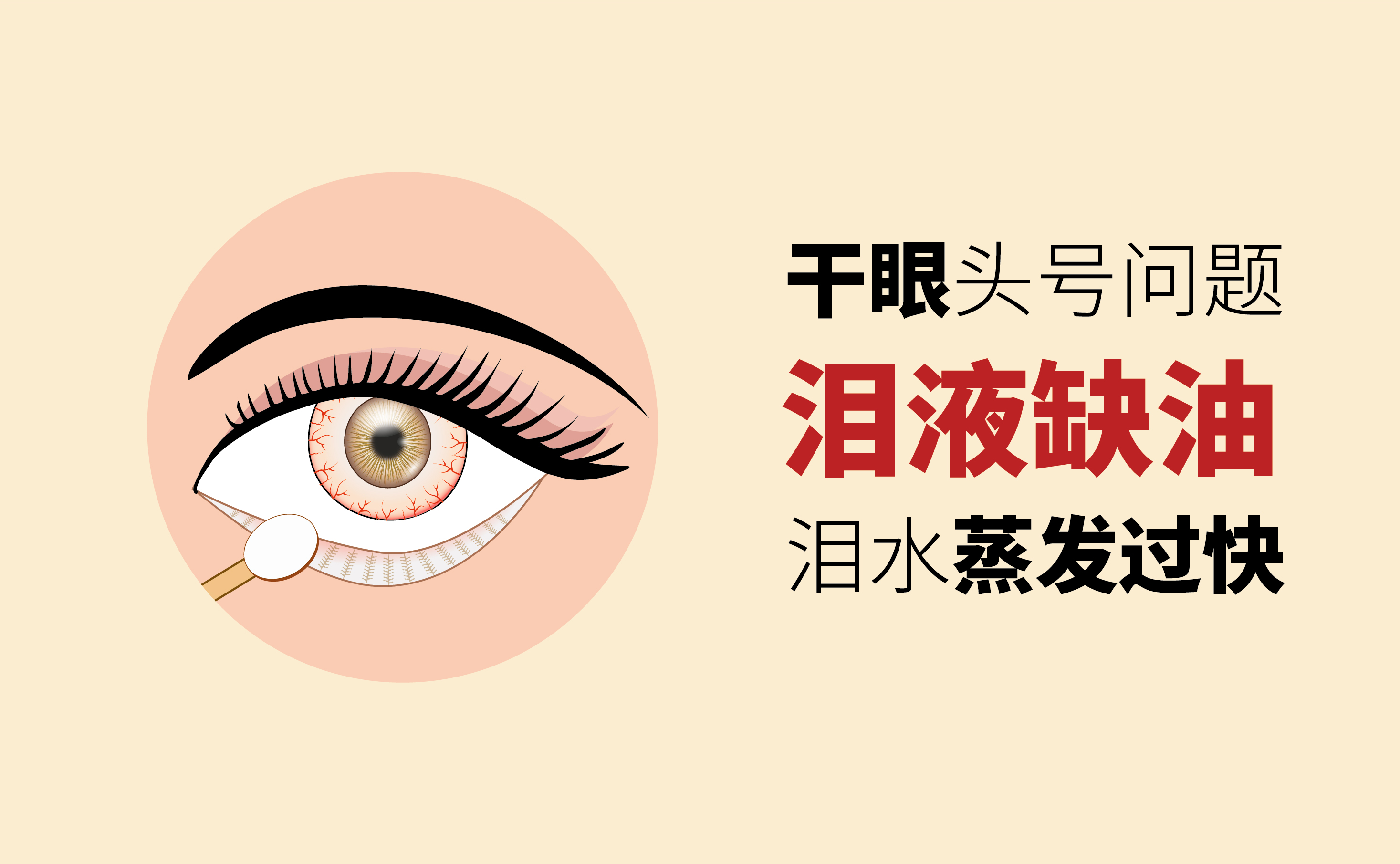 2023110317224622897278876.jpg 睑板腺动画1-01.jpg