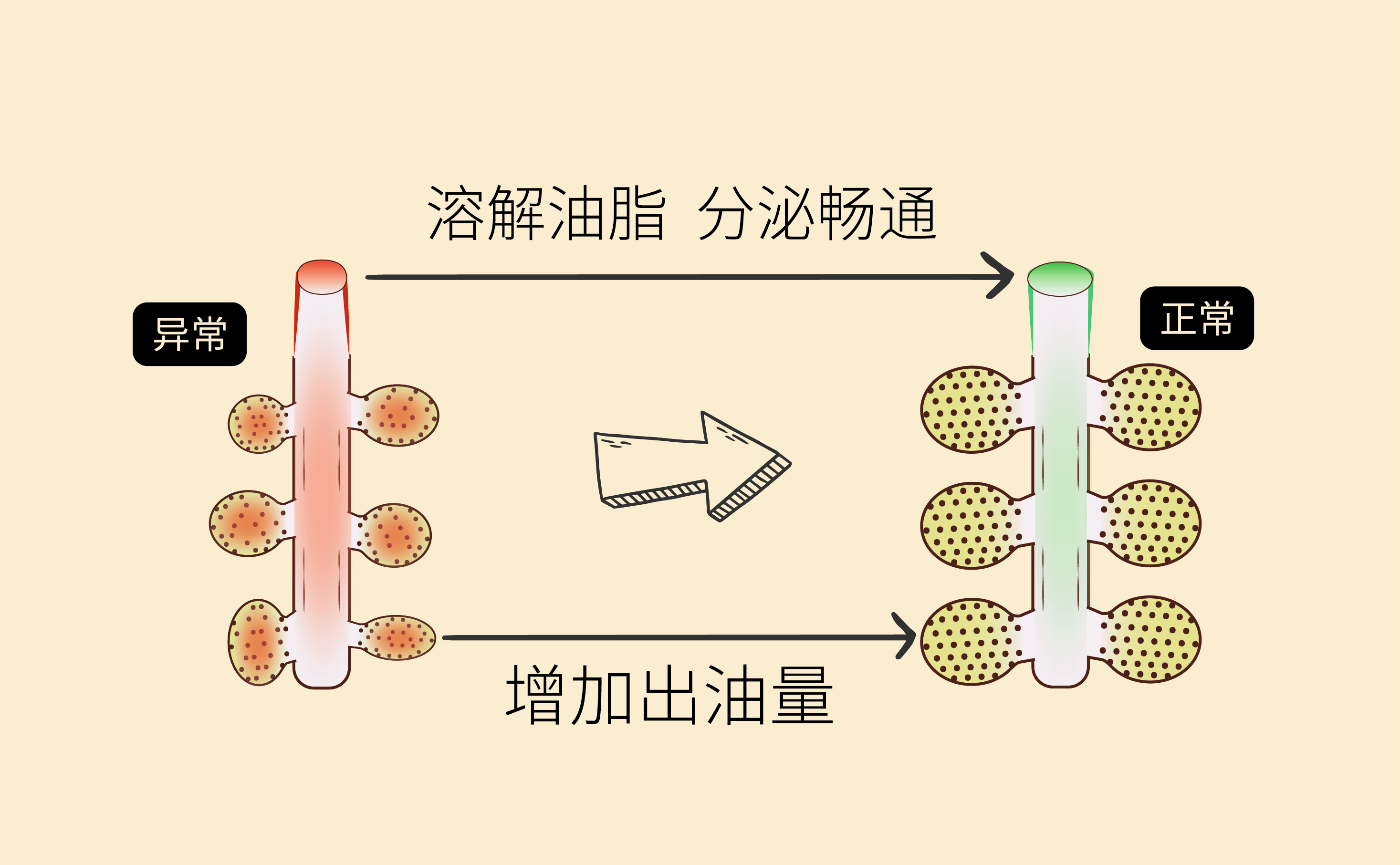 2023110317262077378392205.jpg 睑板腺动画1-07.jpg